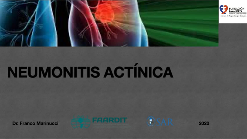 Neumonitis actínica