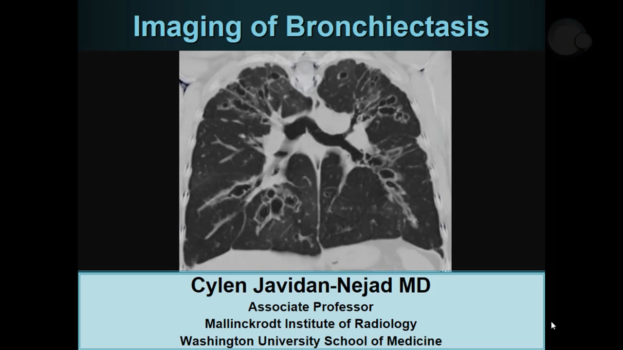 Imágenes de la bronquiectasia