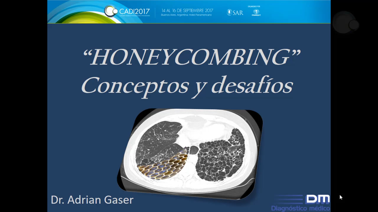 Honeycombing: ¿qué es? 