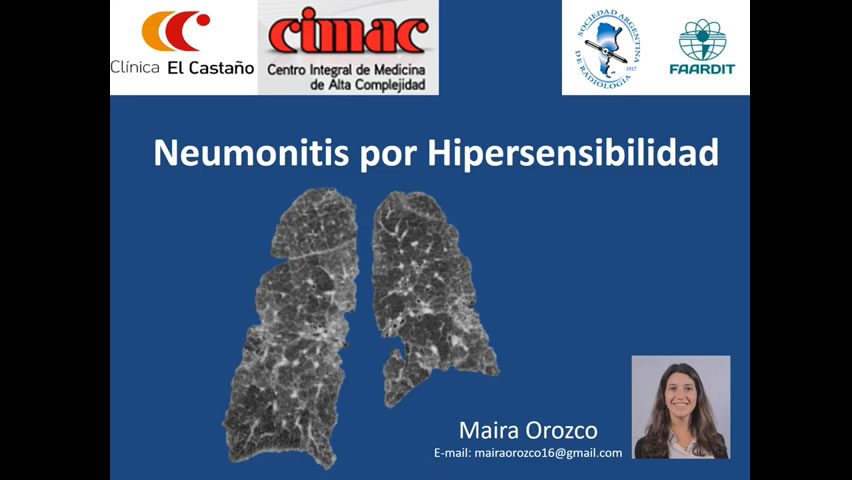 Actualización en Neumonitis por Hipersensibilidad