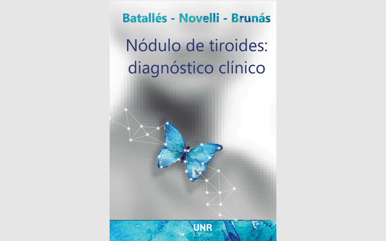 Nódulo de Tiroides: diagnóstico clínico
