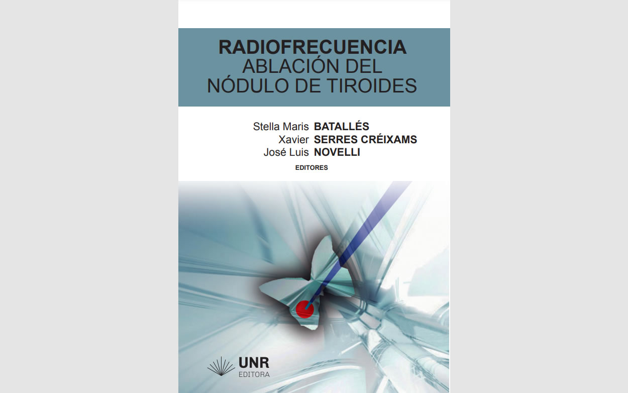 Radiofrecuencia. Ablación del nódulo de tiroides