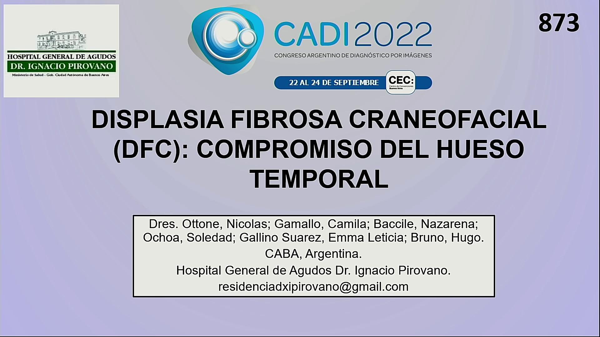 Displasia Fribrosa Craneofacial (DFC): Compromiso del hueso temporal