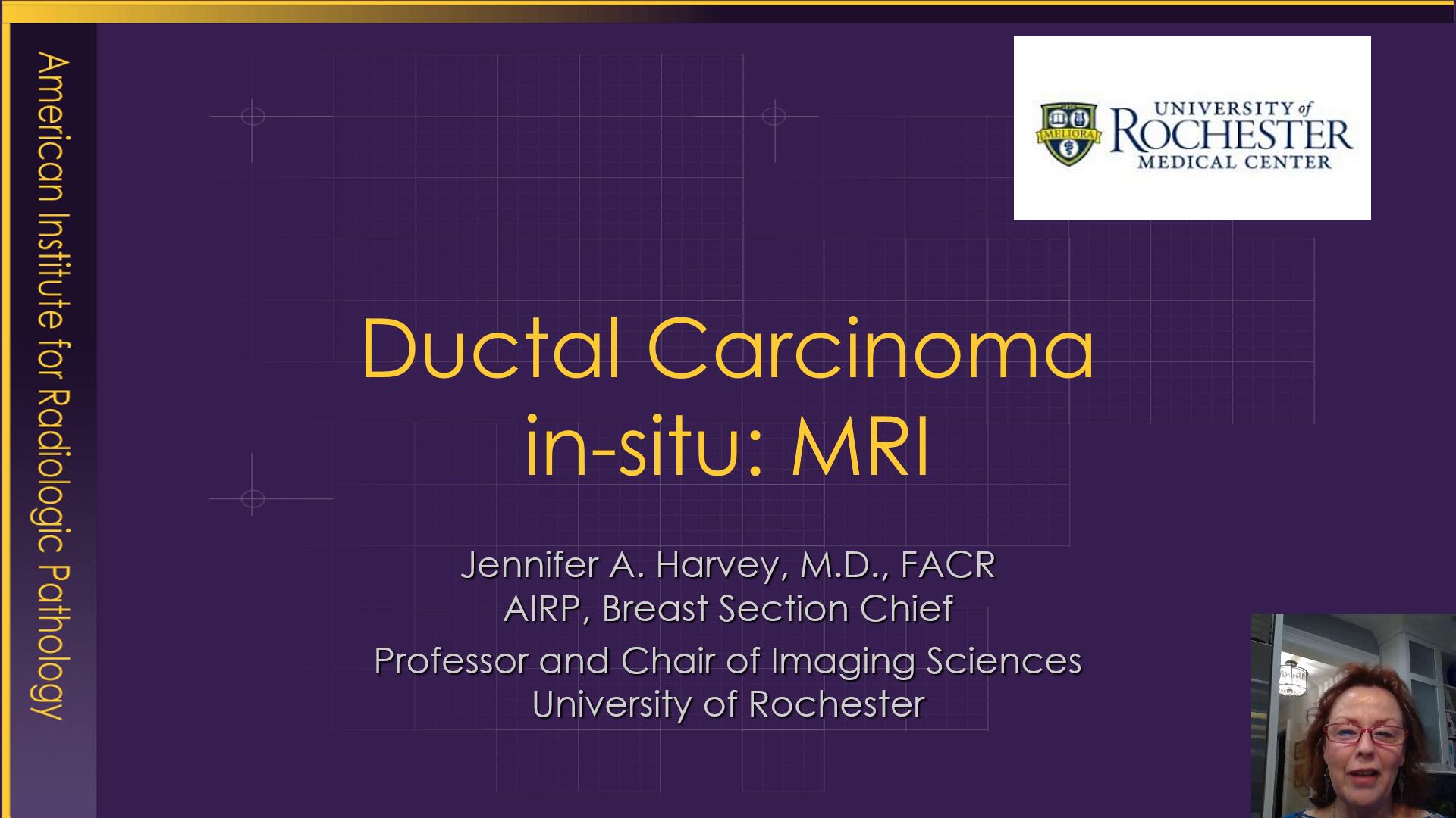 Ductal Carcinoma in-situ: MRI