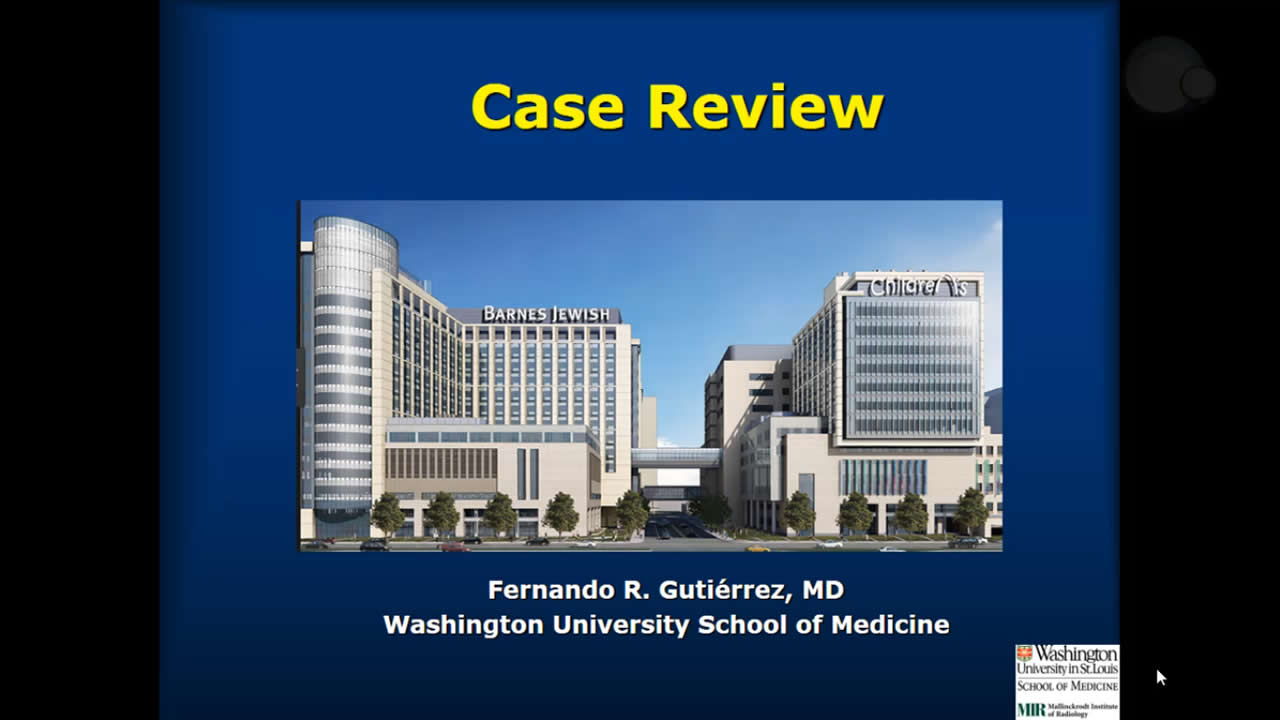 Discusión de casos problemáticos de la Clínica de Enfermedades Pulmonares Intersticiales de la Universidad de Washington
