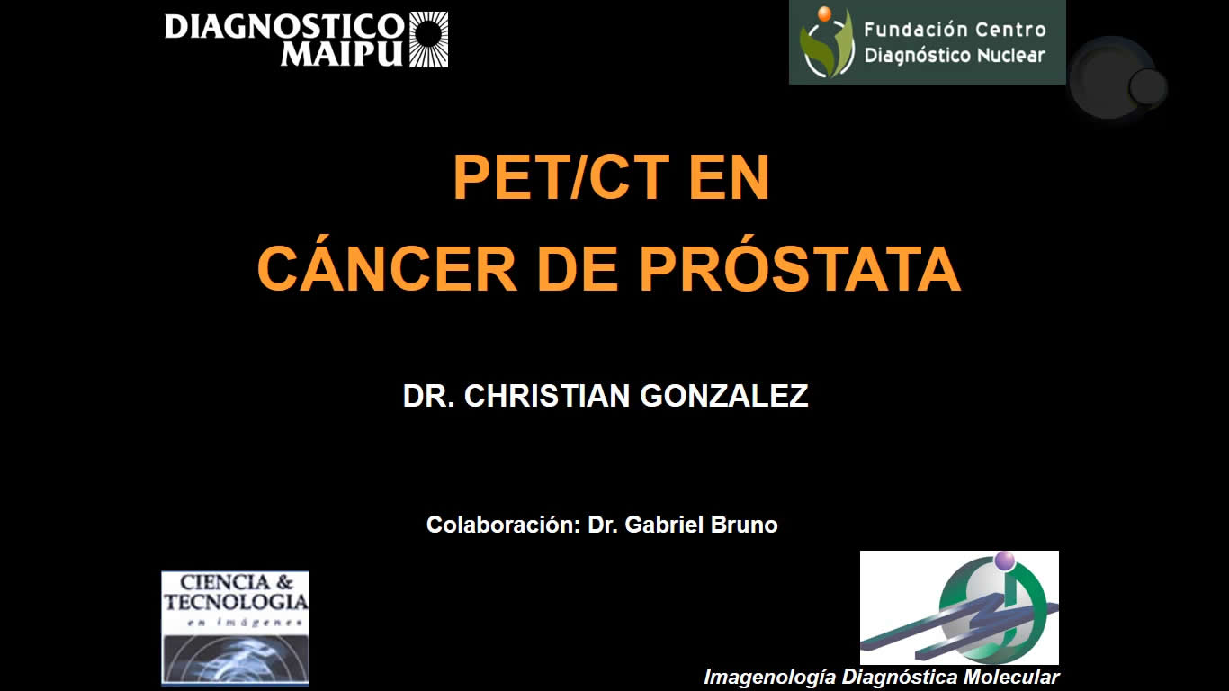 PET/CT en cáncer de próstata